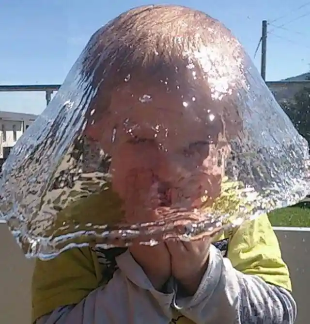 Boy Eaten By Jellyfish