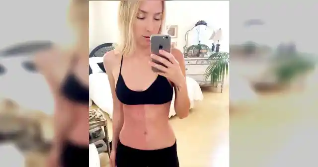 Woman With Strange Birthmark Makes Surprising Discovery