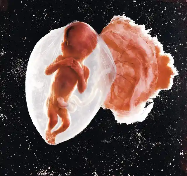 18-Week Fetus