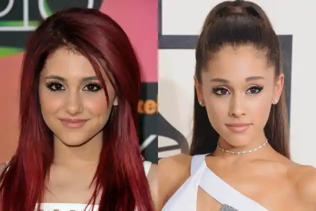 Celebrities Speak Out About Plastic Surgeries — Confession, Regret And Denial