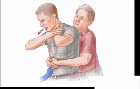 Avoid A Choking Incident By Pressing The Abdomen