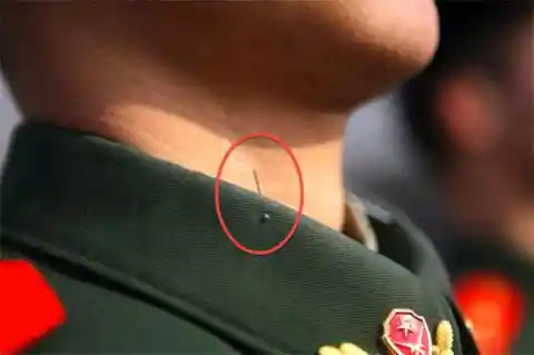 Posture Pins